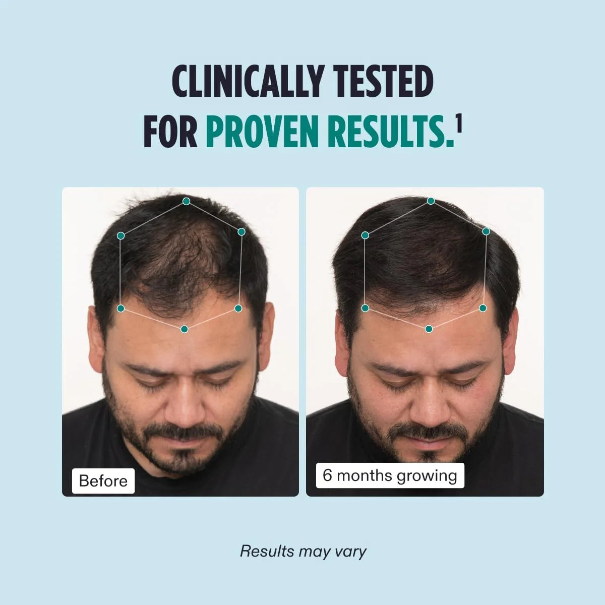 Nutrafol Men Hair Growth Supplement β 120 Capsules β Thicker Hair Support