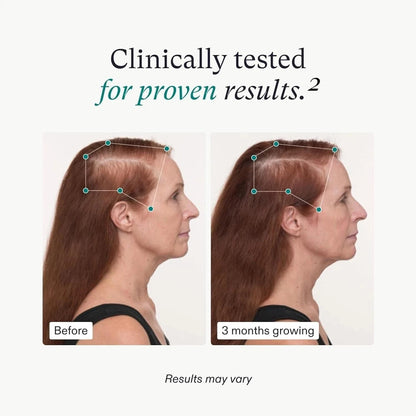 Nutrafol Women's Balance Hair Growth Supplement – 120 Capsules – For Women